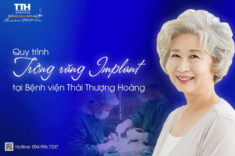 Quy trình trồng răng Implant tại Thái Thượng Hoàng